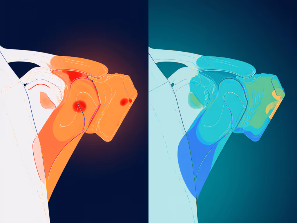 pressure-mapping-shoulder-comparison